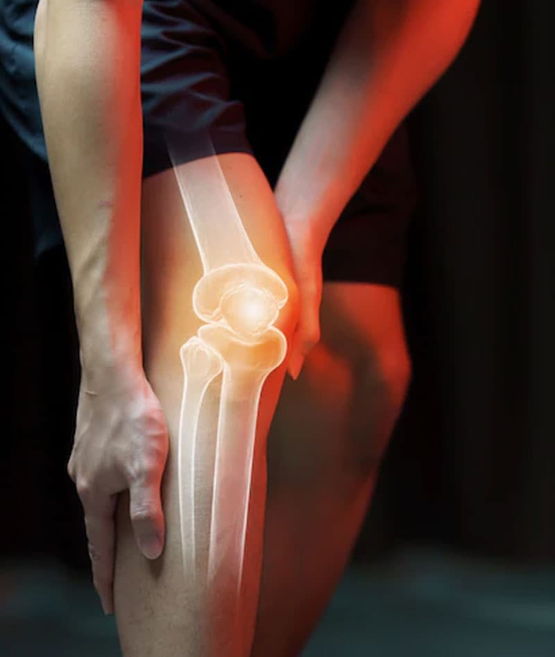 Knee arthritis anatomy diagram